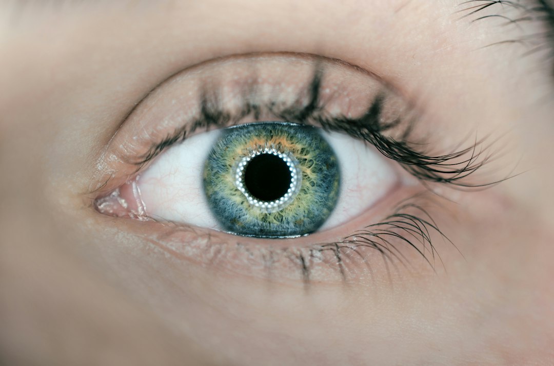 Photo astigmatism progression eye condition