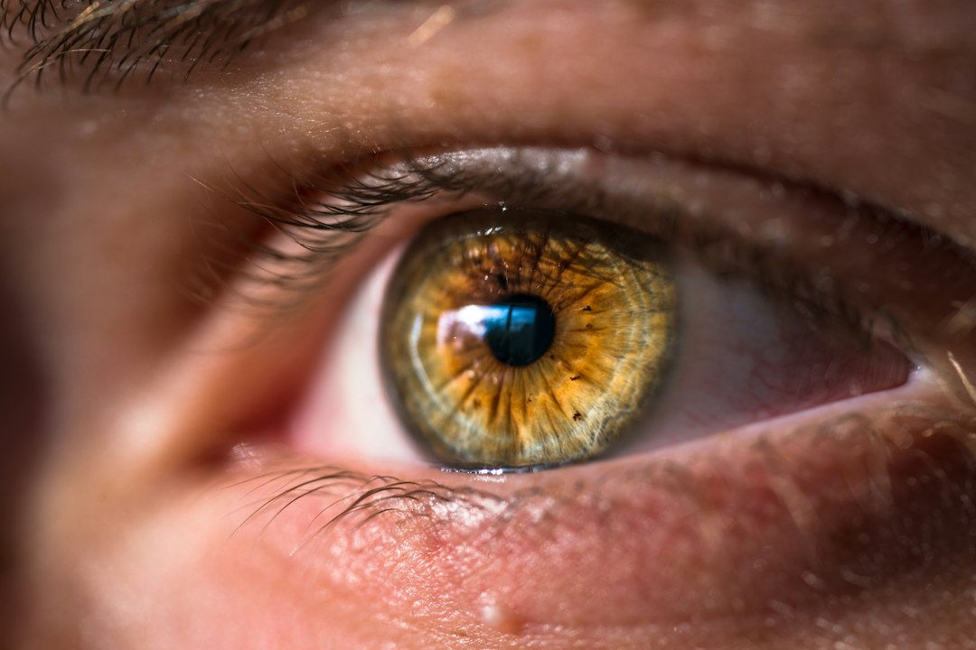 Photo astigmatism progression eye condition
