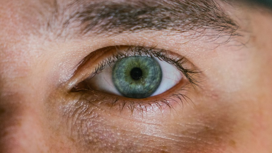 astigmatism progression eye condition