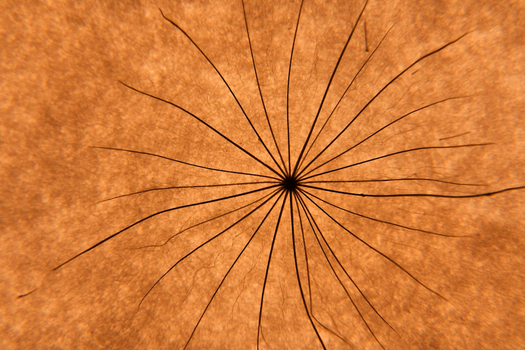 Photo worsening astigmatism causes diagram