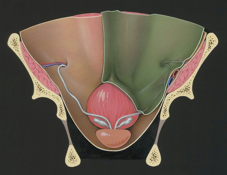 worsening astigmatism causes diagram
