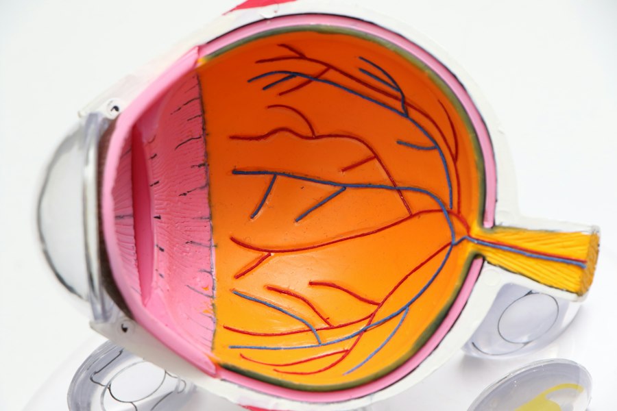 Photo short sightedness symptoms diagram